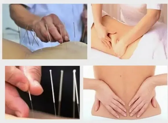 Châm Cứu - Ấn Huyệt: Sự Kết Hợp Tinh Hoa Y Học Trong Giảm Đau