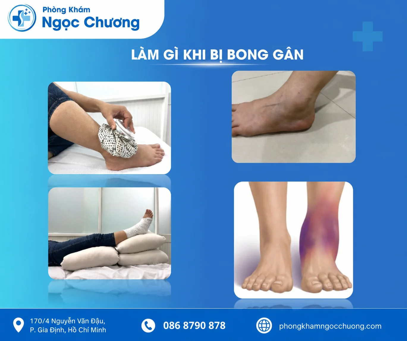 Xử Lý Bong Gân & Tổn Thương Dây Chằng: Hết Sưng Đau, Ngừa Tái Phát