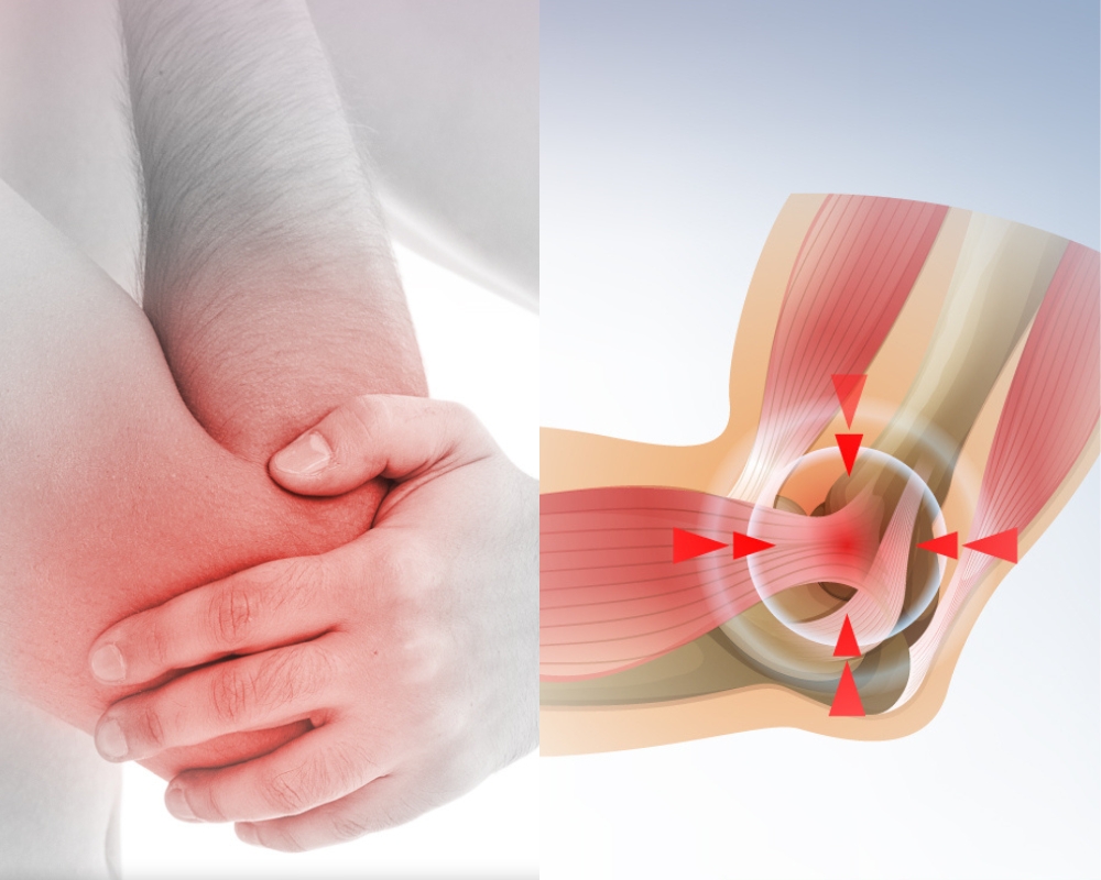 Điều Trị Viêm Gân & Điểm Bám Gân: Loại Bỏ Tận Gốc Điểm Đau Khó Chịu